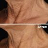 Dermalogica Neck Fit Contour Serum 50ml - Image 3